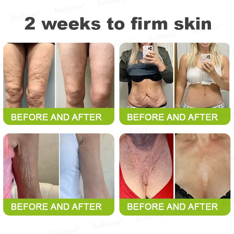 The Vita-A Retinal Shot Tightening Booster (15mL)