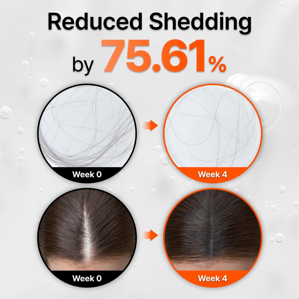 Hair Growth Serum with Exosome Technology — Scalp Ampoule