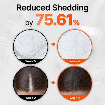 Hair Growth Serum with Exosome Technology — Scalp Ampoule