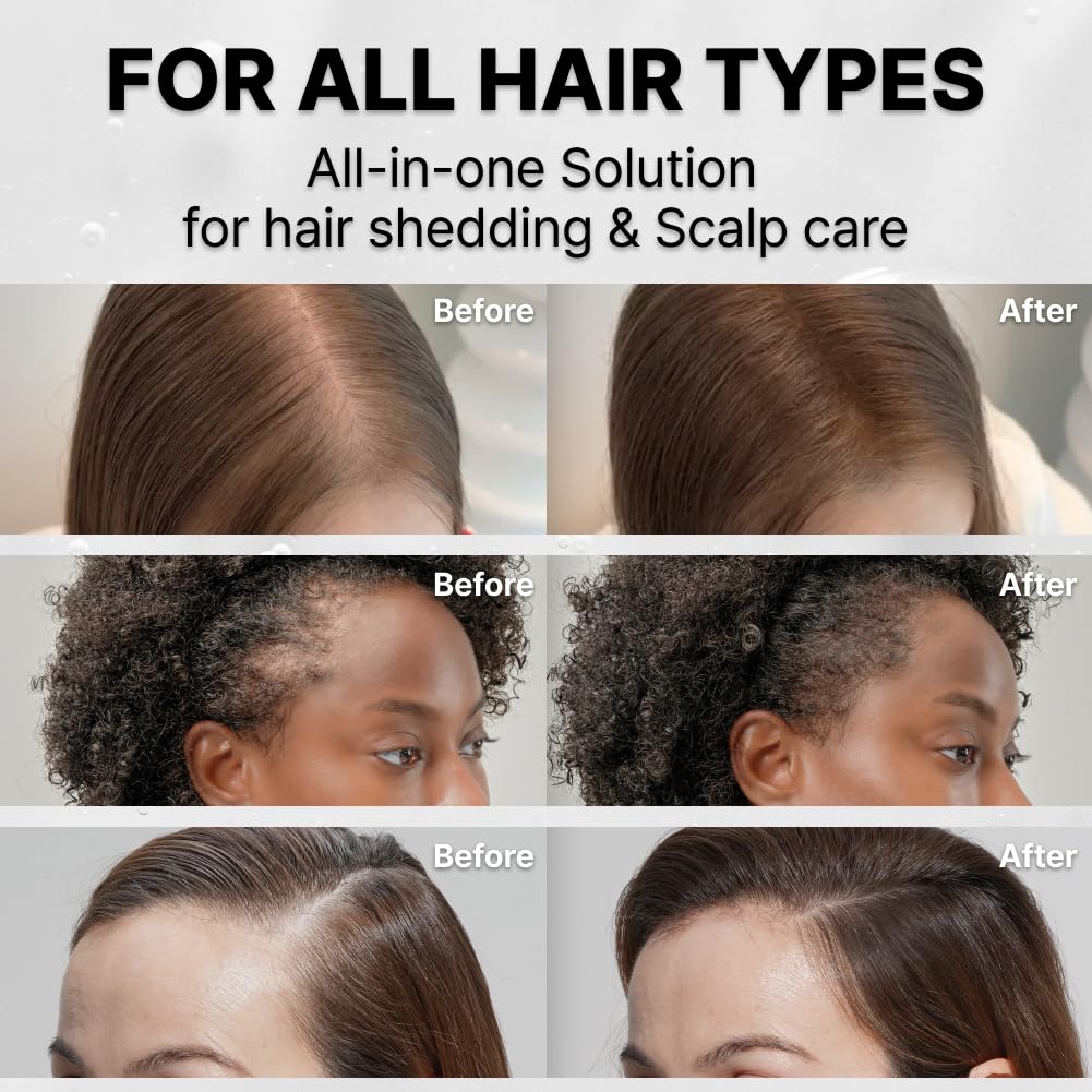 Hair Growth Serum with Exosome Technology — Scalp Ampoule