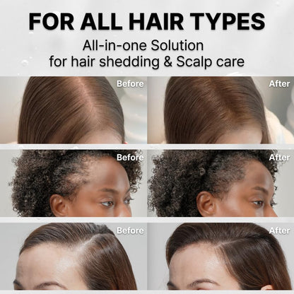 Hair Growth Serum with Exosome Technology — Scalp Ampoule