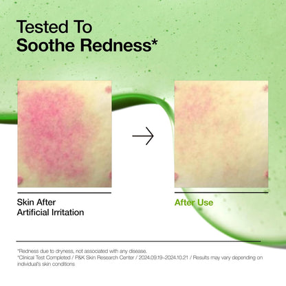 Azelaic Acid 10 Hyaluron Redness Soothing Serum