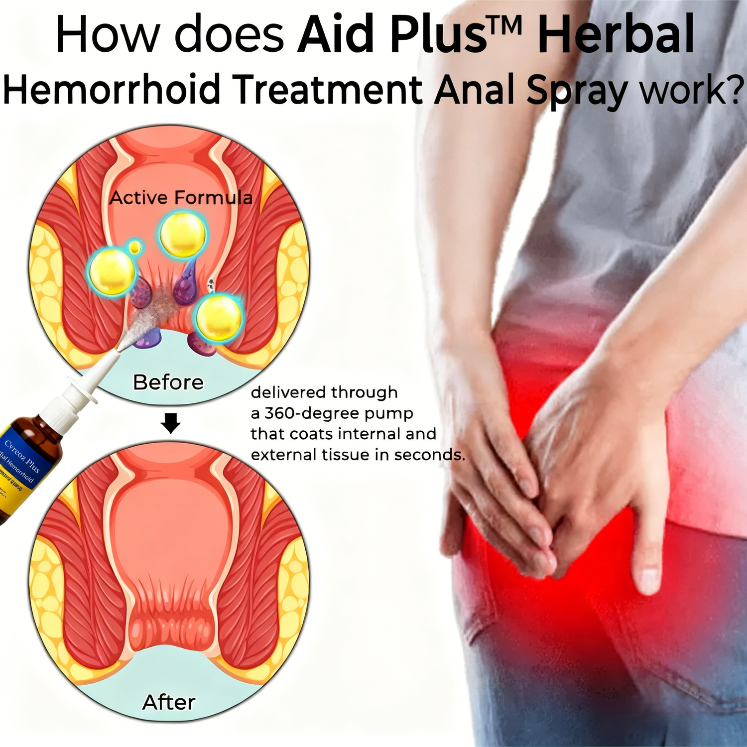 Aid Plus™ Herbal Hemorrhoid Spray