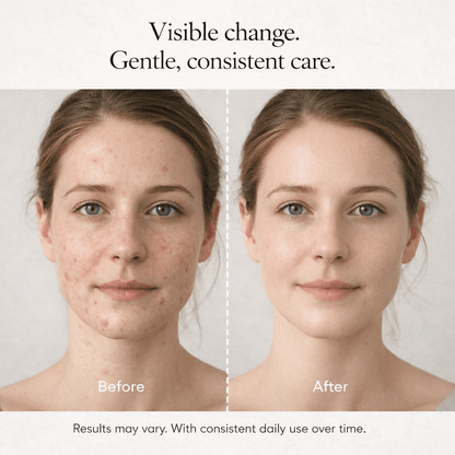 Fade Scars. Smooth Wrinkles. Restore Your Skin’s Confidence — Naturally. - Zalunas