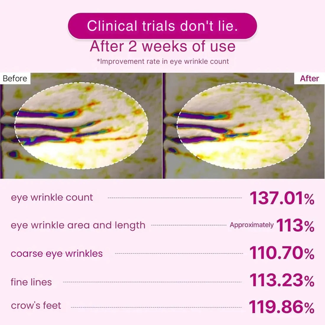 The Vita-A Retinal Shot Tightening Booster (15mL)