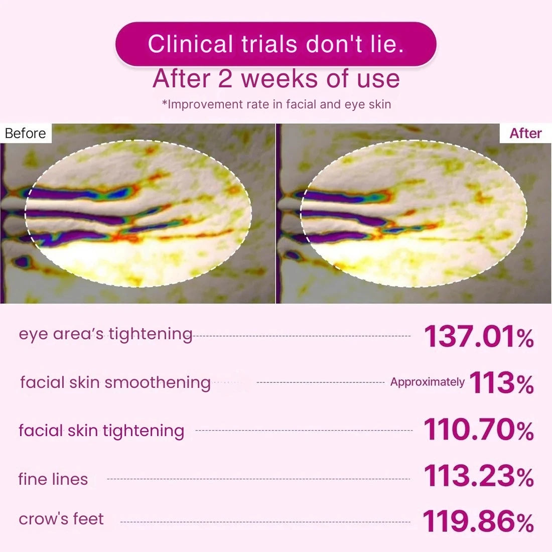 The Vita-A Retinal Shot Tightening Booster (15mL)