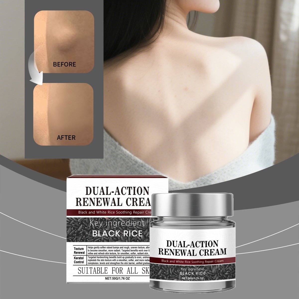 Aid Plus™ Black Rice Essence Cream – Wart, Skin Tag & Spot Remover - Zalunas