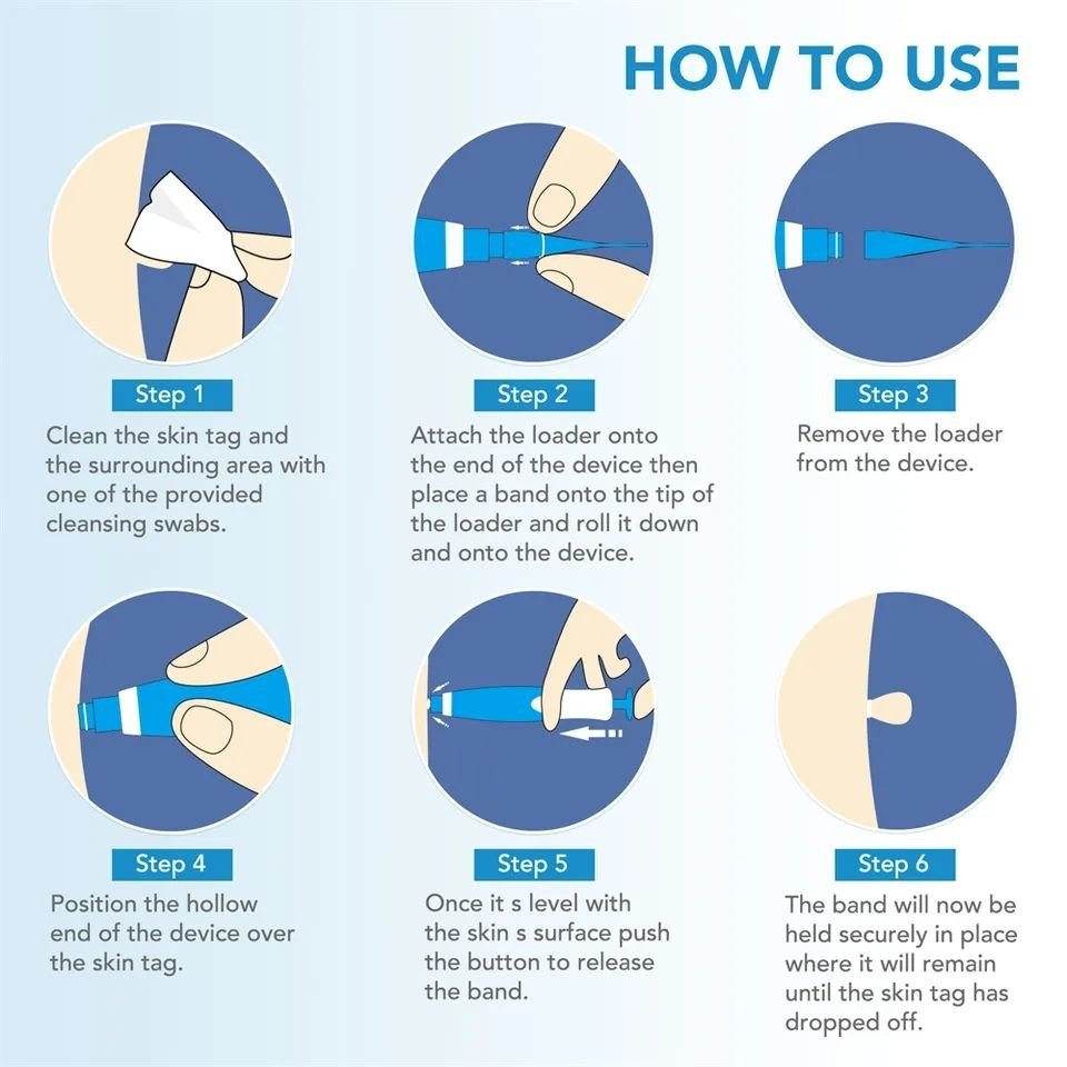 Aid Plus™ Skin Tag Removal Pen – Precision Spot Treatment for Fast, Painless Removal - Zalunas