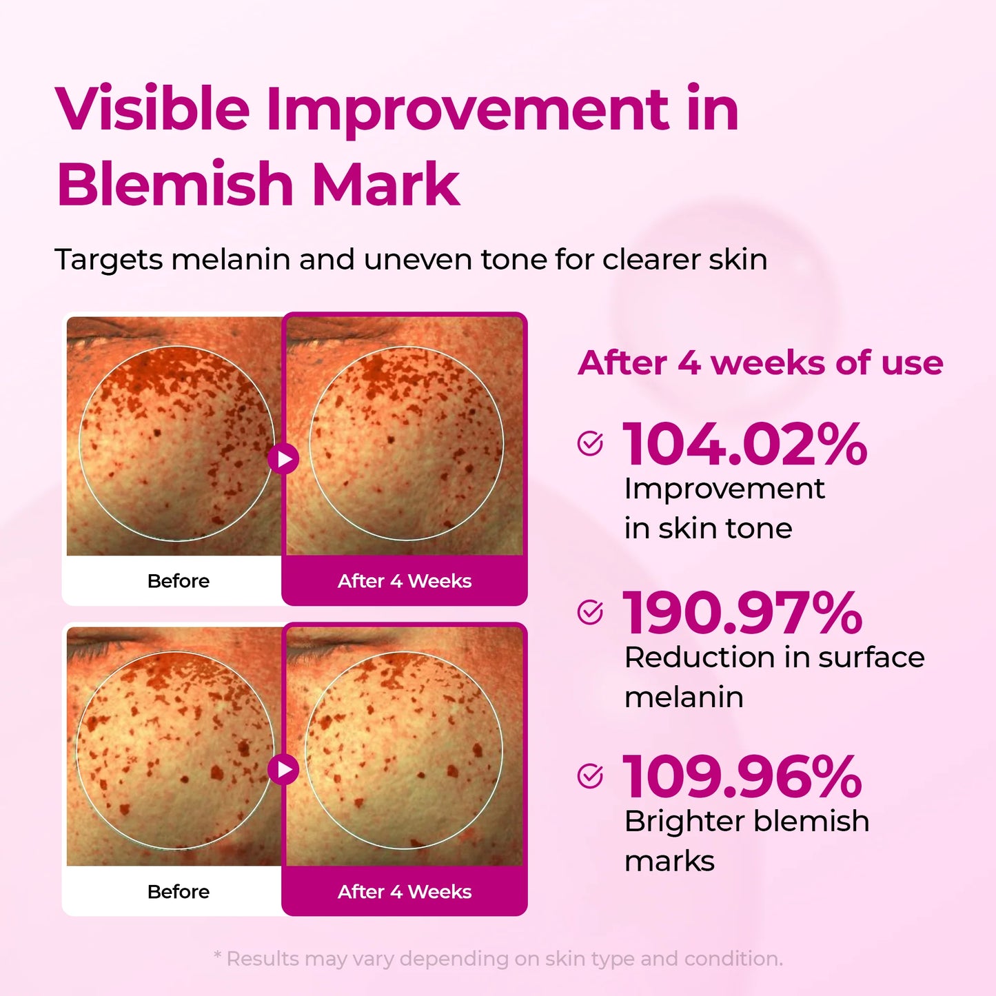 The Vita-A Retinal Shot Tightening Booster (15mL)