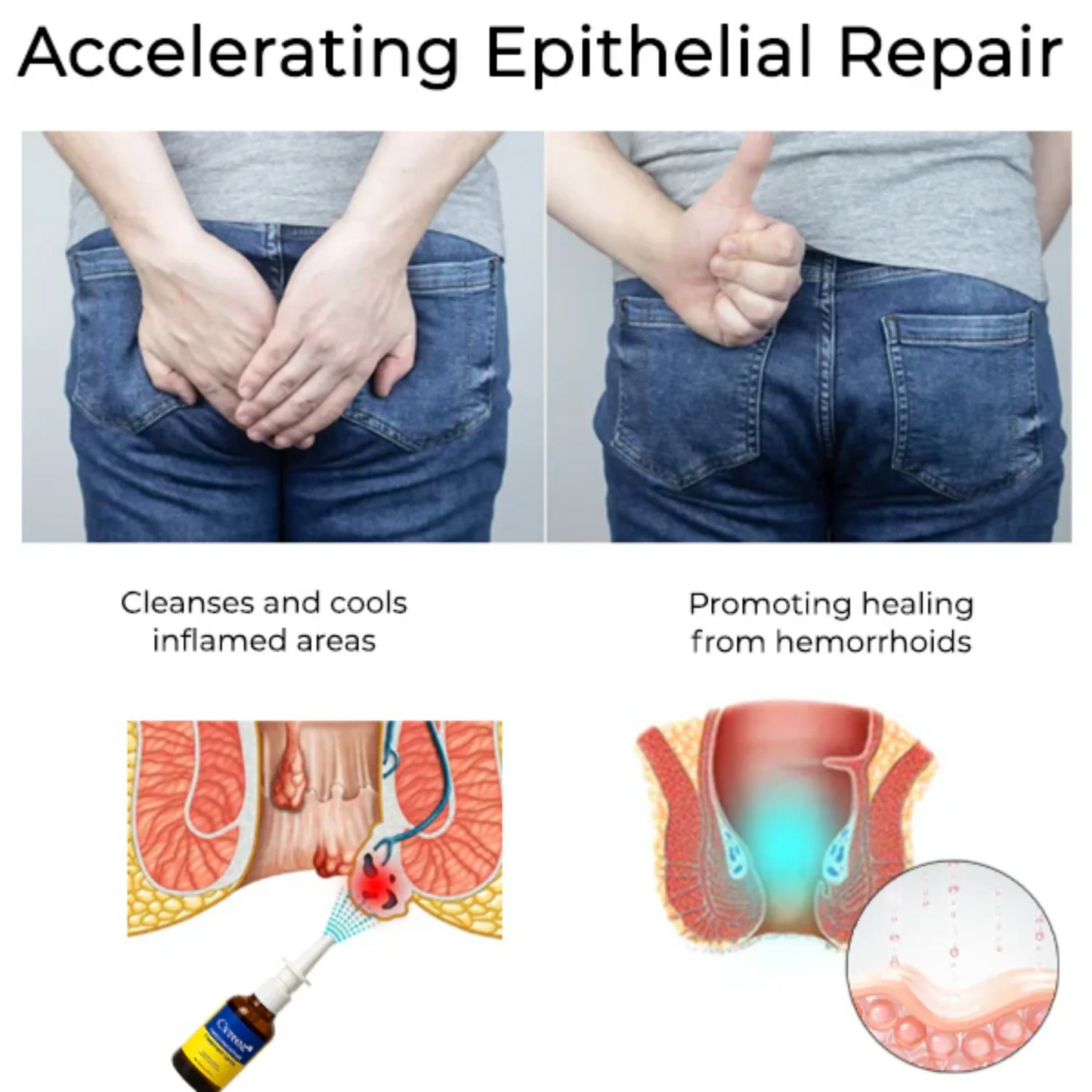 Aid Plus™ Herbal Hemmeroid Spray