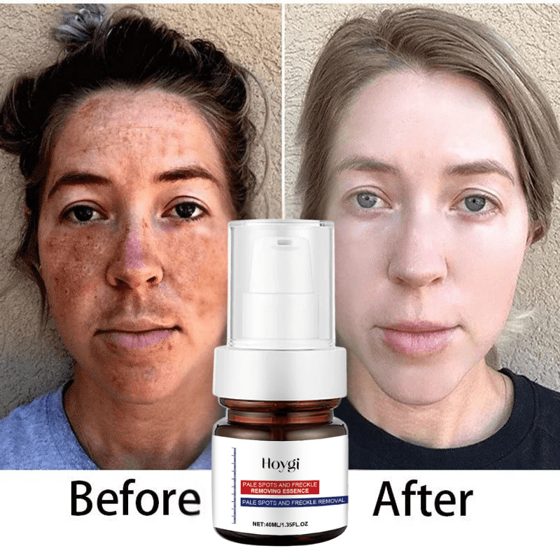 Lumifade Vitamin C Brightening Essence - Zalunas