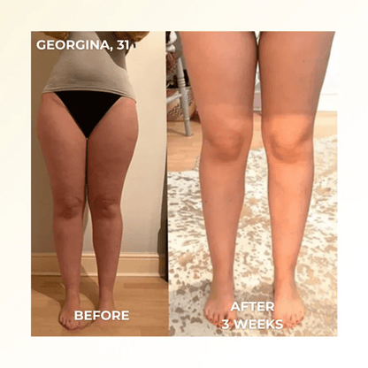 NovaSculpt™ Premium Heat & EMS Sculpting Device - Zalunas