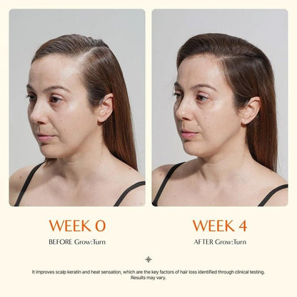 Hair Growth Serum with Exosome Technology — Scalp Ampoule