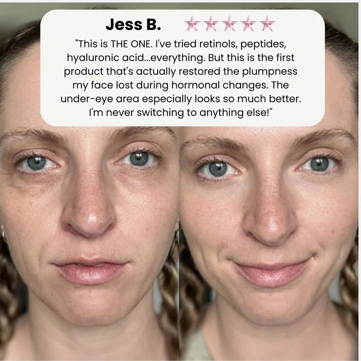 Korean Volufiline® Collagen Serum – Plumps & Lifts Skin - Zalunas