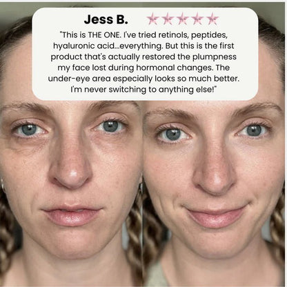 Korean Volufiline® Collagen Serum – Plumps & Lifts Skin - Zalunas