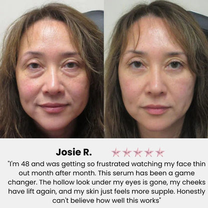 Korean Volufiline® Collagen Serum – Plumps & Lifts Skin - Zalunas